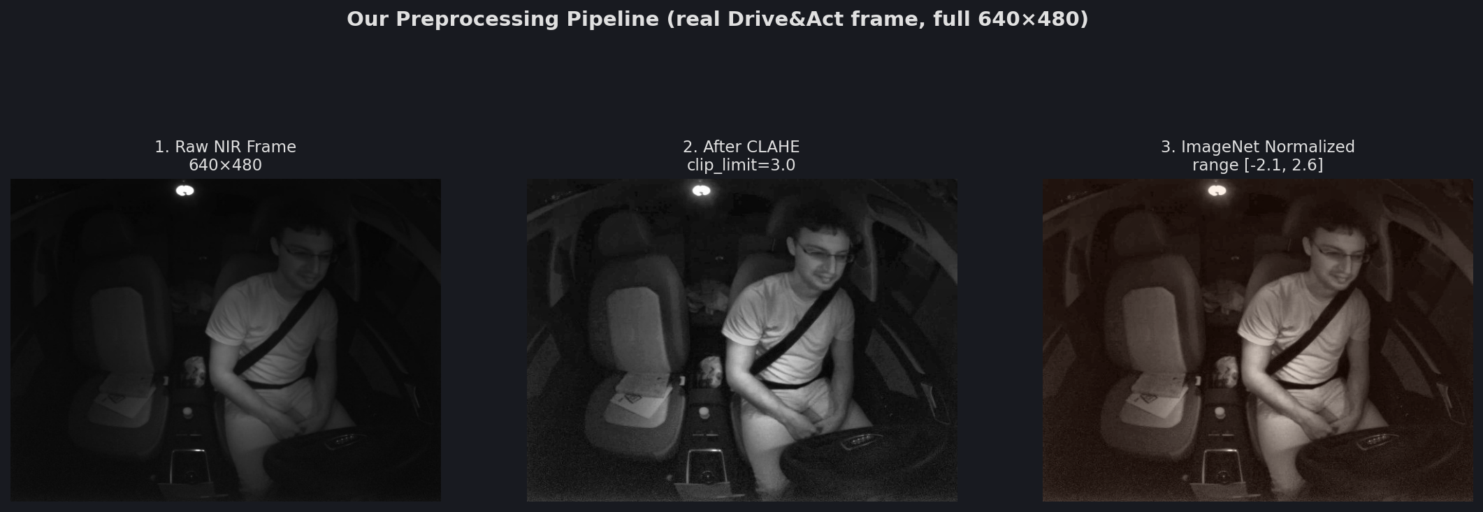 Preprocessing Pipeline